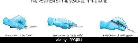 vector illustration of the position of the scalpel in the hand Stock Vector