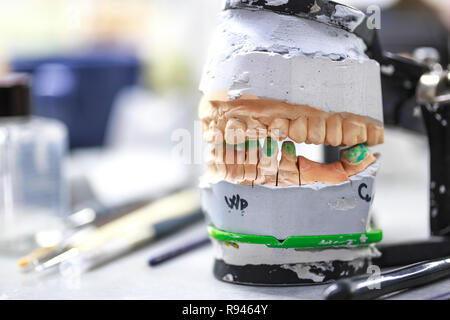 Dental articulator in dental lab. Closeup of device used in Making Prosthetic Facial Dental on dental lab. Stock Photo