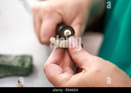 Dental technician working on a metallic prosthesis. Hand of dental technician working at a prosthesis. Stock Photo