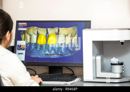 Person working on computer with dental software platform for make dental prosthesis. Dental prosthesis manufacturing process using dedicated software. Stock Photo