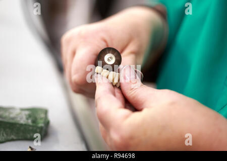 Specialist working on a metallic prosthesis. Hand of dental technician polishing at a prosthesis Stock Photo