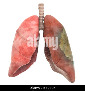 Lungs disease, infection concept, 3D rendering isolated on white background Stock Photo