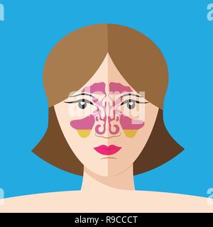 sinusitis disease, vector nose illustration, sinus anatomy, human respiratory system. Flat style10 eps Stock Vector