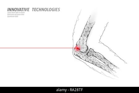 Human elbow joint 3d model vector illustration. Low poly design future technology cure pain treatment. White background and red injury man body arm medicine template Stock Vector
