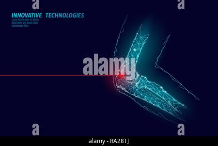 Human elbow joint 3d model vector illustration. Low poly design future technology cure pain treatment. Blue background and red injury man body arm medicine template Stock Vector