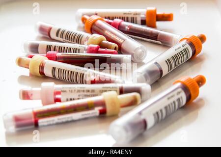 Blood samples, in blood collection tubes, sample container for collection and preparation of blood samples Stock Photo