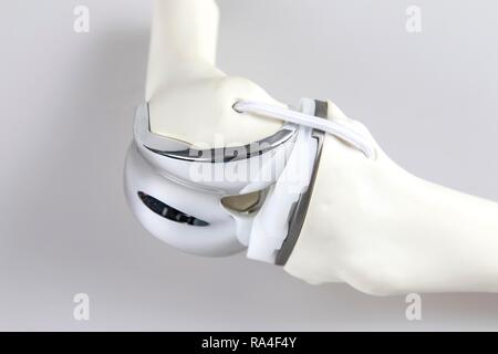 Knee prosthesis, knee endoprosthesis or knee joint prosthesis, on a bone model, artificial knee joint, Germany Stock Photo