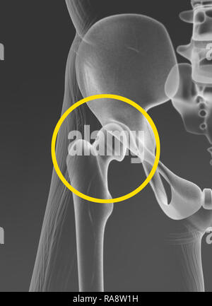 Hip joint, pelvis, medically 3D artwork, radiography Stock Photo