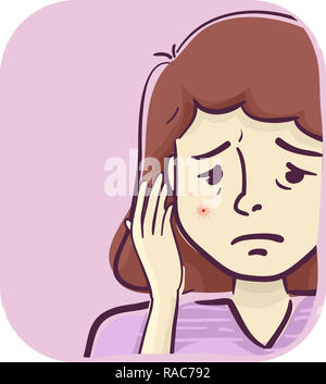 Illustration of a Girl with Red Veiny Spot on Her Face Stock Photo