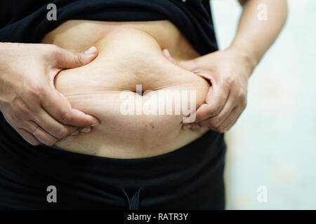 Overweight Asian woman show fat belly at office. Stock Photo