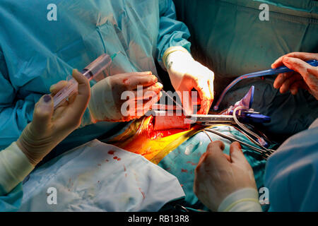 Suture of an lung emphysema surgery in an infant andmedical assistance close-up Stock Photo