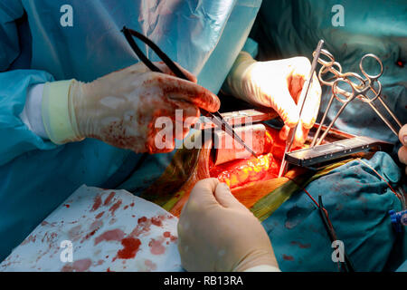 Suture of an lung emphysema surgery in an infant andmedical assistance close-up Stock Photo