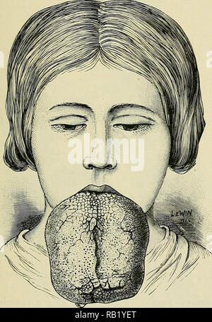 'Tumours, innocent and malignant; their clinical characters and appropriate treatment' (1911) Stock Photo