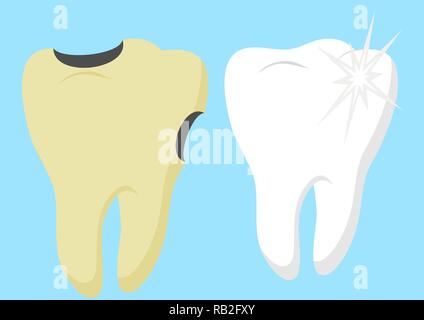 Healthy cartoon tooth and decayed tooth with. Dental care and hygiene. Good and bad for your teeth. Vector illustration isolated on white background Stock Vector
