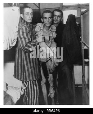 Photograph of a Czech victim of dysentery in Nazi camp at Flossenburg, Germany. Dated 1945 Stock Photo