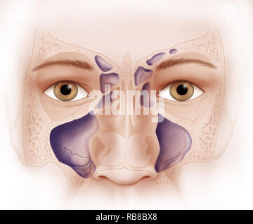 Human sinuses, illustration Stock Photo: 118698877 - Alamy