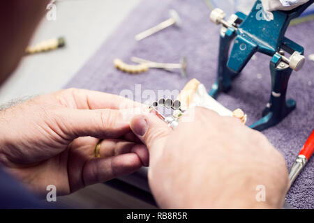 Dental technician working on a metallic prosthesis Stock Photo