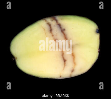 Spraing symptom of potato mop top virus (PMTV) in potato tuber section Stock Photo