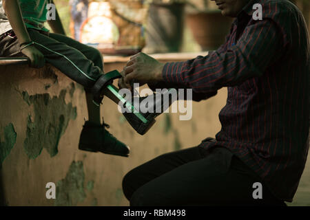 India. 5th Mar, 2017. A father ties his son's shoelace at Chingari Rehabilitation Center.Chingari cares for victims of the Bhopal Gas Disaster.The Bhopal Gas Disaster was a gas leak incident on the night of 2-3 December 1984 at the Union Carbide plant in Bhopal. Over 500,000 people were exposed to the toxic methyl isocyanate (MIC) gas as they slept. The final death toll is estimated to be between 15,000 and 20,000. Credit: Ryan Ashcroft/SOPA Images/ZUMA Wire/Alamy Live News Stock Photo