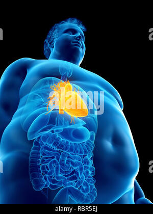 Illustration of an obese man's heart. Stock Photo