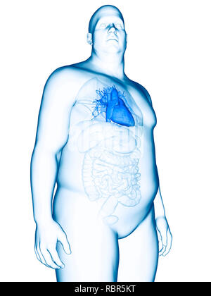 Illustration of an obese man's heart. Stock Photo