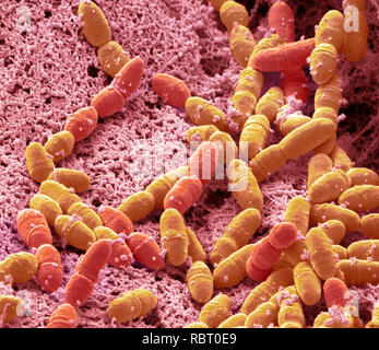 Streptococcus mutans. Coloured scanning electron micrograph (SEM). S ...