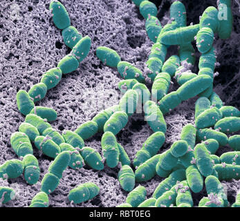 Streptococcus mutans. Coloured scanning electron micrograph (SEM). S. mutans is a coccoid shaped, Gram-positive, anaerobic bacteria that is part of th Stock Photo