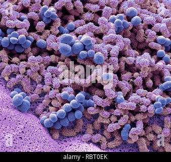 Foot bacteria. Scanning electron micrograph (SEM) of bacteria that live ...