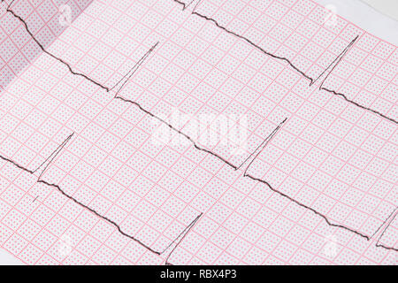 Close up of an electrocardiogram in paper form, medical healthcare Stock Photo