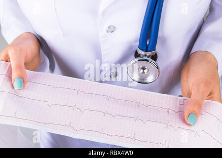 Cardiogram printout. Electrocardiogram, ecg in hand, palm of doctor ...