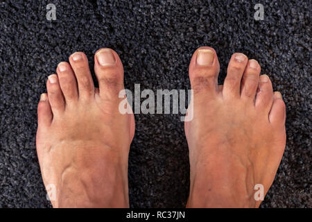 Photo of a human foot Stock Photo - Alamy