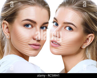 Collage of woman with lifting lines on face. Stock Photo