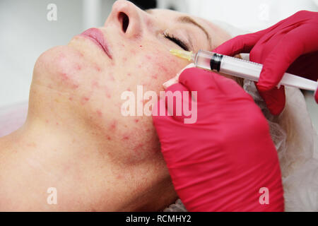 doctor cosmetologist dermatologist conducts a session of mesotherapy for an elderly woman. Stock Photo