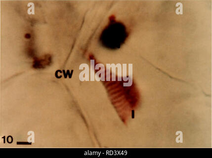 . Cytological methods for the detection, identification, and characterization of orchid viruses and their inclusion bodies. Orchids; Virus diseases of plants. -16-. Please note that these images are extracted from scanned page images that may have been digitally enhanced for readability - coloration and appearance of these illustrations may not perfectly resemble the original work.. Ko, Nan-Jing. Stock Photo