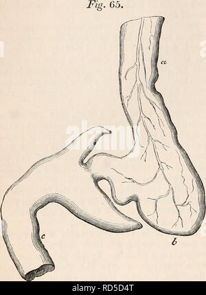 . The cyclopædia of anatomy and physiology. Anatomy; Physiology; Zoology. 92 PANCREAS. form; they are two in number,ample, conical, and recurved, projecting back from the duo- denum at its very commencement, so as to give it a barbed or arrow-head appearance, as seen in the drawing (fig. 65.). The stomach in this fish is very small, and the duodenum. Pyloric cceca of the Turbot. a, oesophagus; b, stomach ; c, intestine. (Drawn one-third the natural diameter.) very large, and the food probably passes into the intestine with but little delay. The caeca in this case must be considered an exceptio Stock Photo