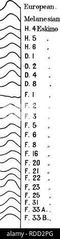 Comparison of bone disease in fossil man and contemporary man. The ...