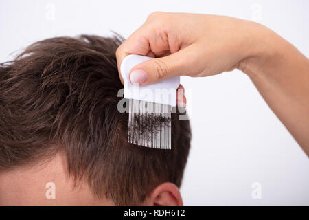 Close-up Of A Female Doctor Examining Man's Hair With Comb Stock Photo