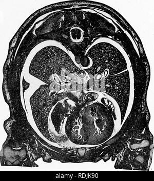 . Practical anatomy of the rabbit : an elementary laboratory textbook in mammalian anatomy . Rabbits; Anatomy, Comparative. VII. A TRANSVERSE SECTION OF THE TTORAX.. Please note that these images are extracted from scanned page images that may have been digitally enhanced for readability - coloration and appearance of these illustrations may not perfectly resemble the original work.. Bensley, B. A. (Benjamin Arthur), 1875-1934. Toronto : University press Stock Photo