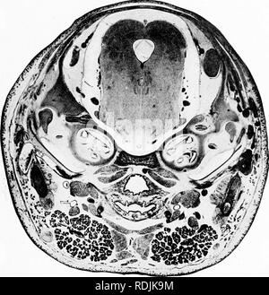 . Practical anatomy of the rabbit : an elementary laboratory textbook in mammalian anatomy . Rabbits; Anatomy, Comparative. V. A TRANSVERSE SECTION OF THE AUDITORY REGION.. Please note that these images are extracted from scanned page images that may have been digitally enhanced for readability - coloration and appearance of these illustrations may not perfectly resemble the original work.. Bensley, B. A. (Benjamin Arthur), 1875-1934. Toronto : University press Stock Photo