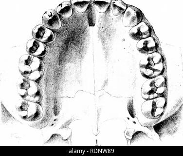 . Science from an easy chair; a second series. Science; Natural history. Plate VII.. Teeth of the upper jaw of man. inc.2 m.2: m.3:-. Please note that these images are extracted from scanned page images that may have been digitally enhanced for readability - coloration and appearance of these illustrations may not perfectly resemble the original work.. Lankester, E. Ray (Edwin Ray), Sir, 1847-1929. London, Methuen Stock Photo