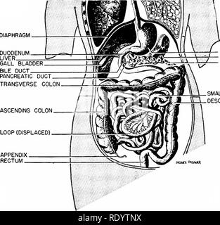 . Principles of modern biology. Biology. The Digestive System - 311 DIAPHRAGM. STOMACH i  - I SPLEEN V S / PANCREAS SMALL INTESTINE D  DESCENDING COLON APPENDIX RECTUM I JKotf t Pdnwtn Fig. 16-24. Abdominal part of the human digestive tract (semidiagrammatic). denum occupies a fixed position in the abdominal cavity, because it is attached di- rectly to the dorsal body wall. All other parts of the small gut, in contrast, enjoy some free- dom of movement, because they are sus- pended to the dorsal body wall by a thin, transparent, sheetlike membrane, the mesen- tery. This mesentery also provid Stock Photo
