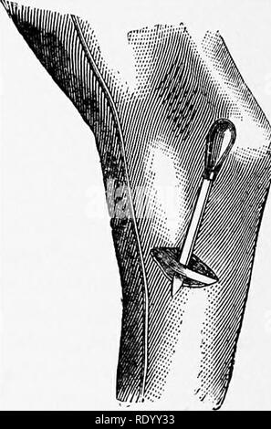. Manual of operative veterinary surgery. Veterinary surgery. Fig. 338.—Tarsal Tenotomy. Cunean Tendon Exposed. Fig. 339.—Tarsal Tenotomy. The Tendon Kaised. across its direction. This incision is generally accompanied by a somewhat troublesome capillary hemorrhage, which ought to be controlled before proceeding further. The tendon may then be felt through its bursa, which is raised with the dissecting forceps and opened, when the tendon is readily exposed. The curved director is then inserted under the tendon, which is easily raised from its tract, and by guiding the tenotome along its groove Stock Photo