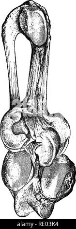 . Fig. 54.—The femoro-tibial joint in a case of infectious rheumatism ...