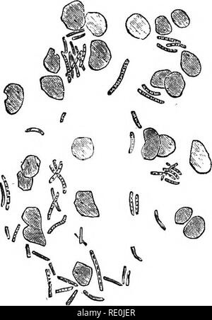 . Pus OF A Pulmonary Abscess in a Horse dead of Glanders. 1. The nuclei ...