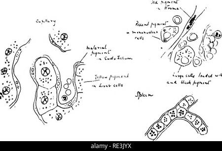 . The practical study of malaria and other blood parasites. Malaria; Mosquitoes; Trypanosoma; Blood. 307 PosT-MoRTEM Changes in Malaria (Marchiafava and Bignami) Brain:— 1. Piinctiform haemorrhages of the men- inges. 2. Punctiform haemorrhages of the white substance of the brain. 3. The brain capillaries may contain nearly every red cell infected. Sporulating forms are especially common.. Fig. 65, Shelving deposition of Pigment in Liver (left), Spleen {right), and Sporulating Parasites in Brain Capillary {bottom) 4.. The capillary endothelium may showfatty degeneration, together with pigmentat Stock Photo