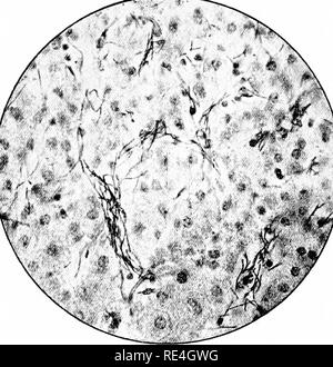 . Micro-organisms and disease. An introduction to the study of specific micro-organisms. Microorganisms. 274 MICRO-ORGANISMS AND DISEASE [chap. adult rats arc, however, infected «uh difficulty, pigs are not^ very susceptible, and dogs and cats are very insusceptible. Infection of animals can be produced by inoculation into the skin and subcutaneous tissue, intraperitoneal or intravascular injections, and by inhalation and ingestion of spores. In woolsorter's disease the usual mode of infection is by inhalation of spores adhering to the wool of the fleeces of animals (sheep, goats) dead of anth Stock Photo