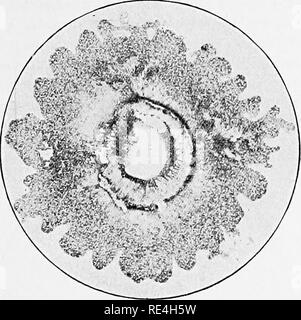 . Micro-organisms and disease. An introduction to the study of specific micro-organisms. Microorganisms. BACILLI : SPECIAL 183. Fig. 55.—Voun'c Colony in Gel/tine Plate of Protel'S 'l'lcaris. As seen under a iMagnifyin^ Glass.. Please note that these images are extracted from scanned page images that may have been digitally enhanced for readability - coloration and appearance of these illustrations may not perfectly resemble the original work.. Klein, E. (Edward), 1844-1925. London, Macmillan and Co. , Ltd. Stock Photo