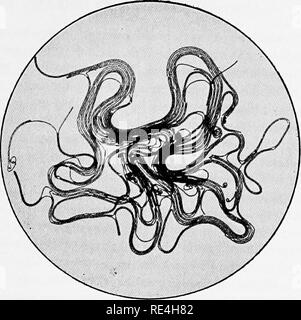 . Micro-organisms and disease. An introduction to the study of specific micro-organisms. Microorganisms. Fig. 44.-A Colony of Filamentous Bacilli (Bacillls Anthracis) UNDER Magnifying Glass-. Please note that these images are extracted from scanned page images that may have been digitally enhanced for readability - coloration and appearance of these illustrations may not perfectly resemble the original work.. Klein, E. (Edward), 1844-1925. London, Macmillan and Co. , Ltd. Stock Photo