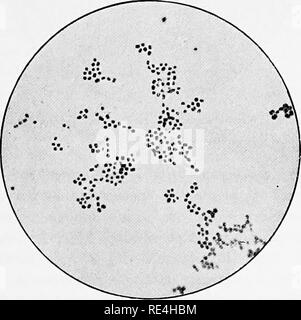 . Micro-organisms and disease. An introduction to the study of specific micro-organisms. Microorganisms. Fig. 25.—A Stained Film Specimen of Bacterium Lactis. X nooo.. Fig. 26.—Micrococcus Uke^, from a Gelatine Cuj-tur^,. Please note that these images are extracted from scanned page images that may have been digitally enhanced for readability - coloration and appearance of these illustrations may not perfectly resemble the original work.. Klein, E. (Edward), 1844-1925. London, Macmillan and Co. , Ltd. Stock Photo