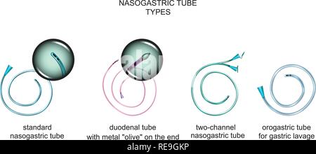 vector illustration of the types of nasogastric tubes Stock Vector